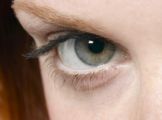 Augenknötchen Herzinfarkt Zusammenhang zwischen gelben Augen Knötchen und Herzinfarkt-Risiko