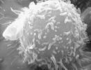 Lymphozyt Morbus Crohn Lymphozyt im menschlichen Darm